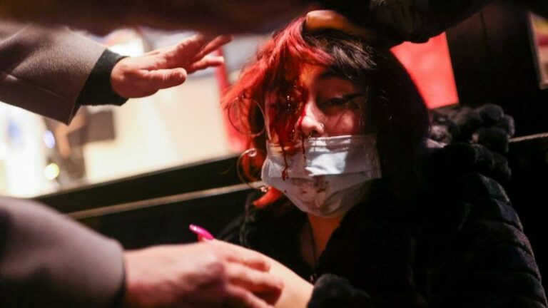 Una manifestante pierde un ojo durante las protestas en soporte a Pablo Hasél