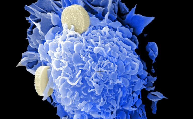 Avance hacia ‘la vacuna’ contra el cáncer